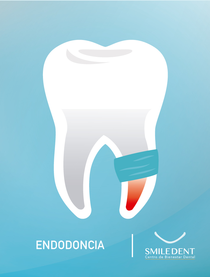 Endodoncia