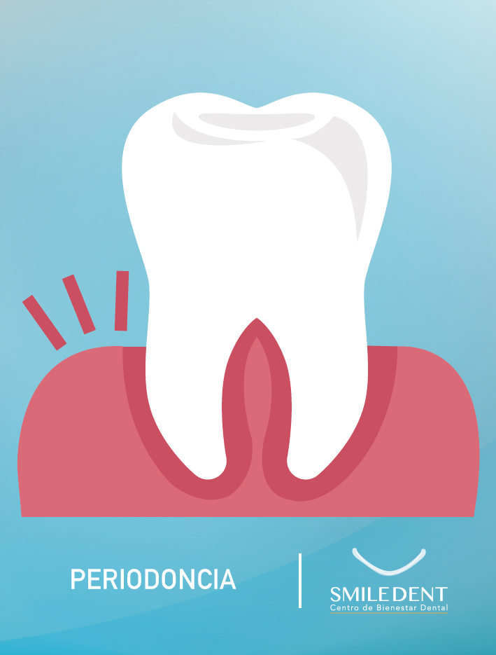 Periodoncia